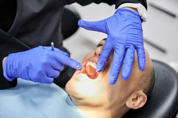 Best Broken Tooth Emergency  in Mansfield, MO